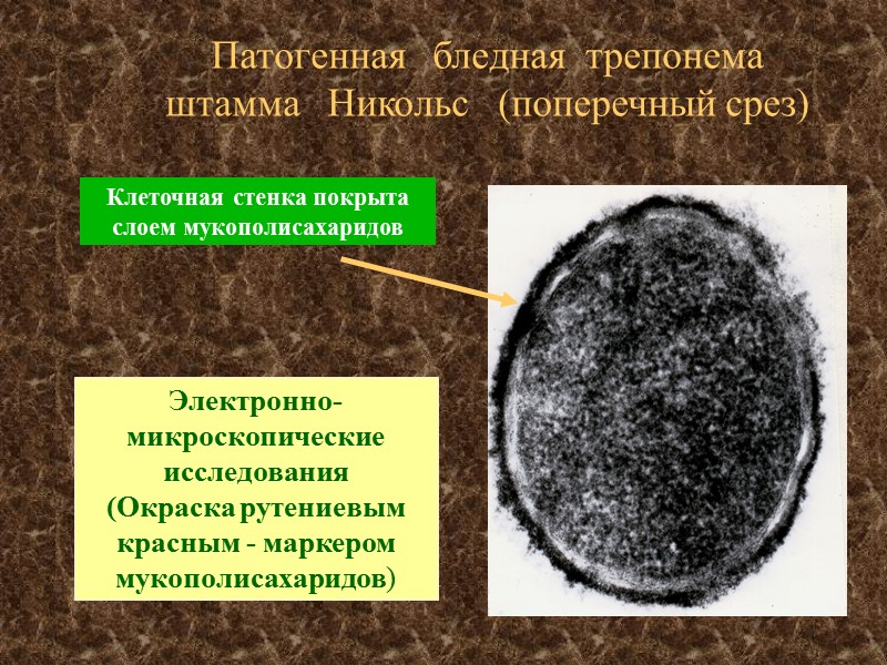 Патогенная   бледная  трепонема штамма   Никольс   (поперечный срез)